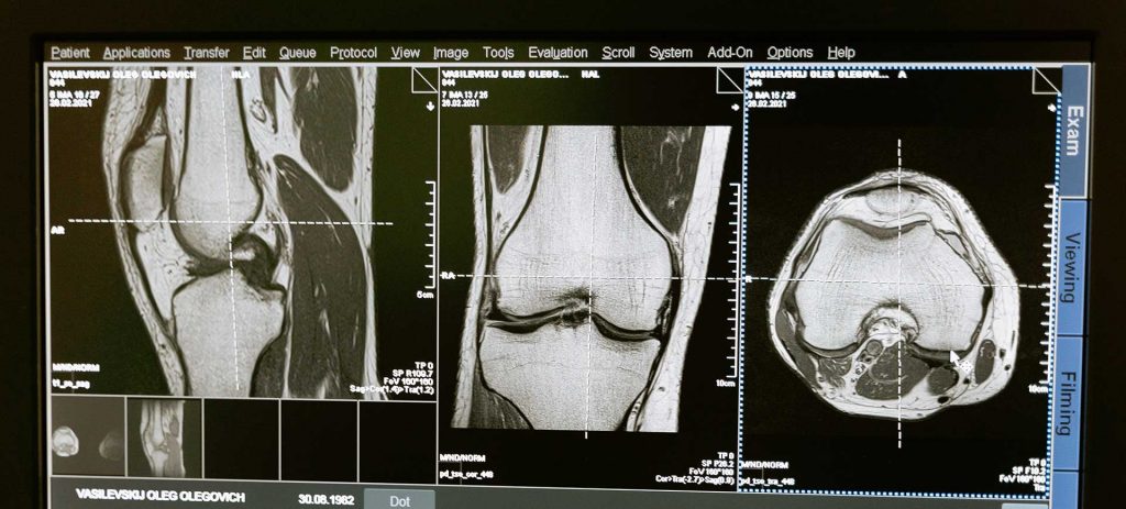 Bone health check up 